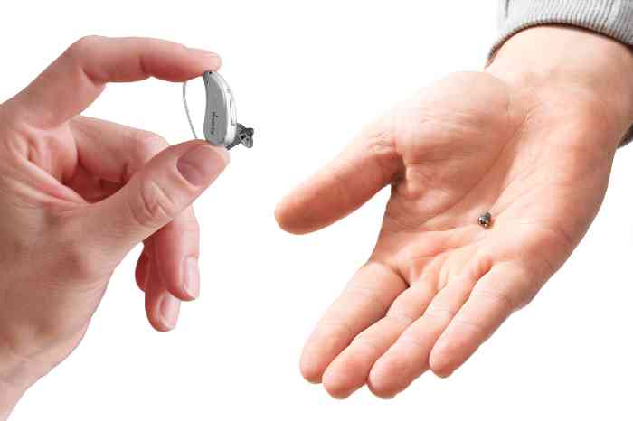 BAHA cochlear implant