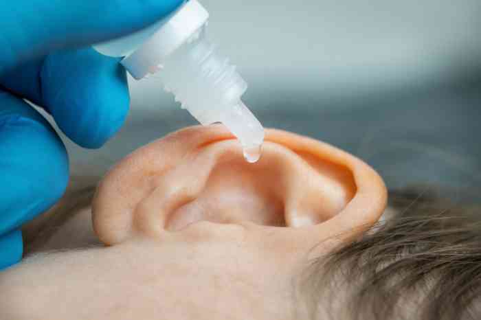 Ear drops are placed in the ear