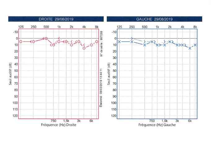 Audiogramme bonne oreille