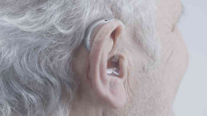 A woman with a behind-the-ear (bte) hearing aid