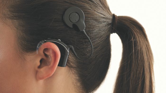 Cochlear implant